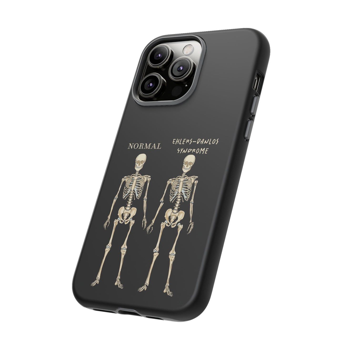 Black phone case with side-by-side skeletons—one labeled “normal,” the other “Ehlers-Danlos Syndrome”—to spread awareness about EDS and its effects. It is shown here at an oblique angle.