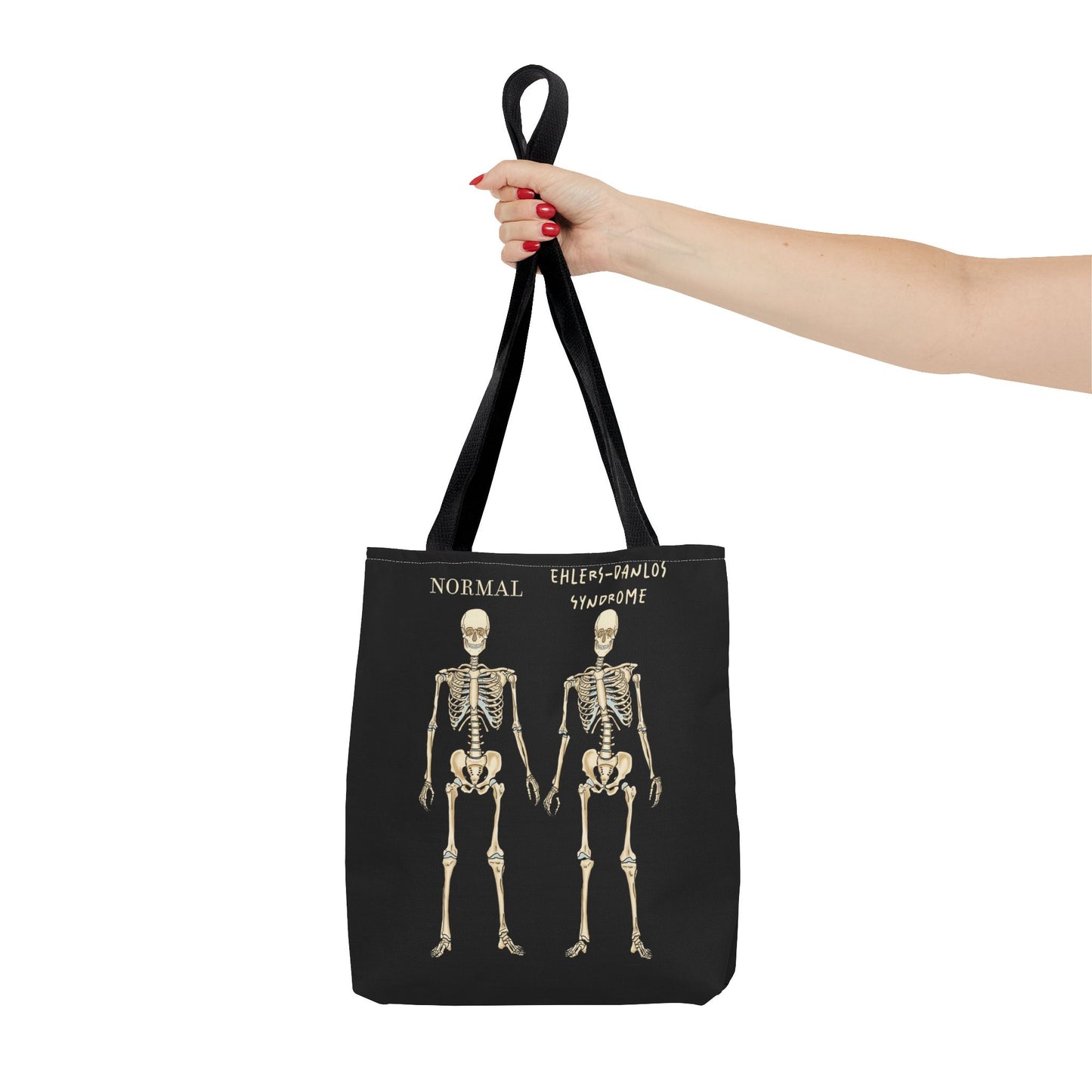 Black tote bag is held out to the side in a woman's hand. The tote displays two skeletons side by side. The first is labeled 'Normal' and the second is labeled 'Ehlers-Danlos Syndrome,' visually illustrating the skeletal effects of EDS.
