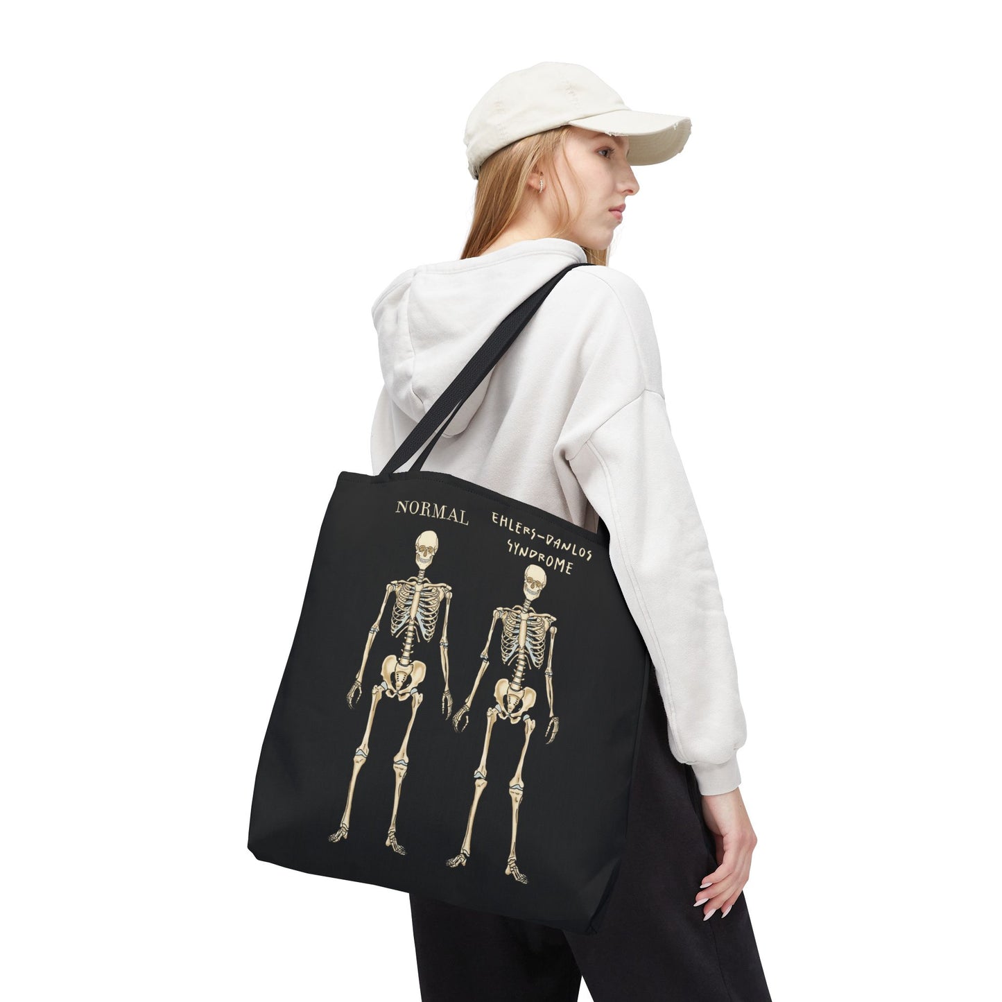 Large black tote bag is over a woman's shoulder. The tote displays two skeletons side by side. The first is labeled 'Normal' and the second is labeled 'Ehlers-Danlos Syndrome,' visually illustrating the skeletal effects of EDS.
