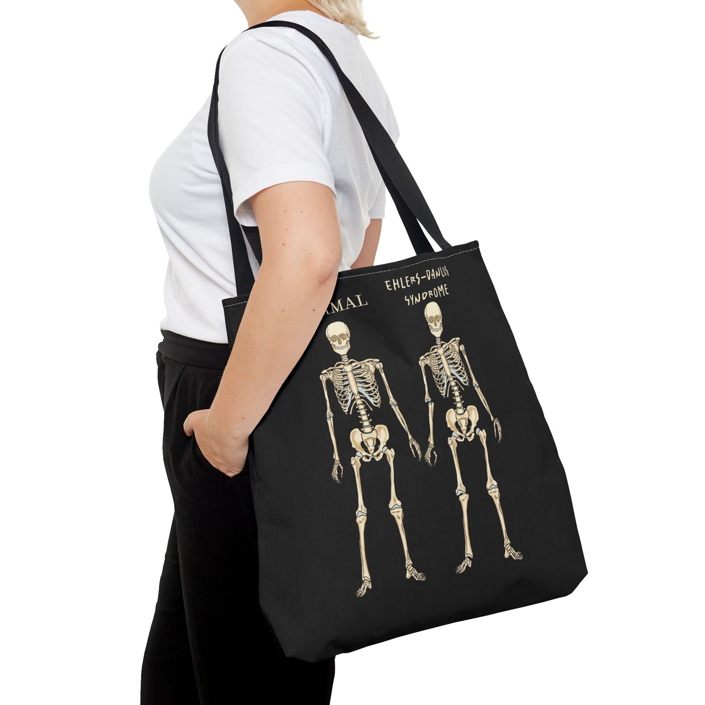 Very large black tote bag is over a woman's shoulder. The tote displays two skeletons side by side. The first is labeled 'Normal' and the second is labeled 'Ehlers-Danlos Syndrome,' visually illustrating the skeletal effects of EDS.