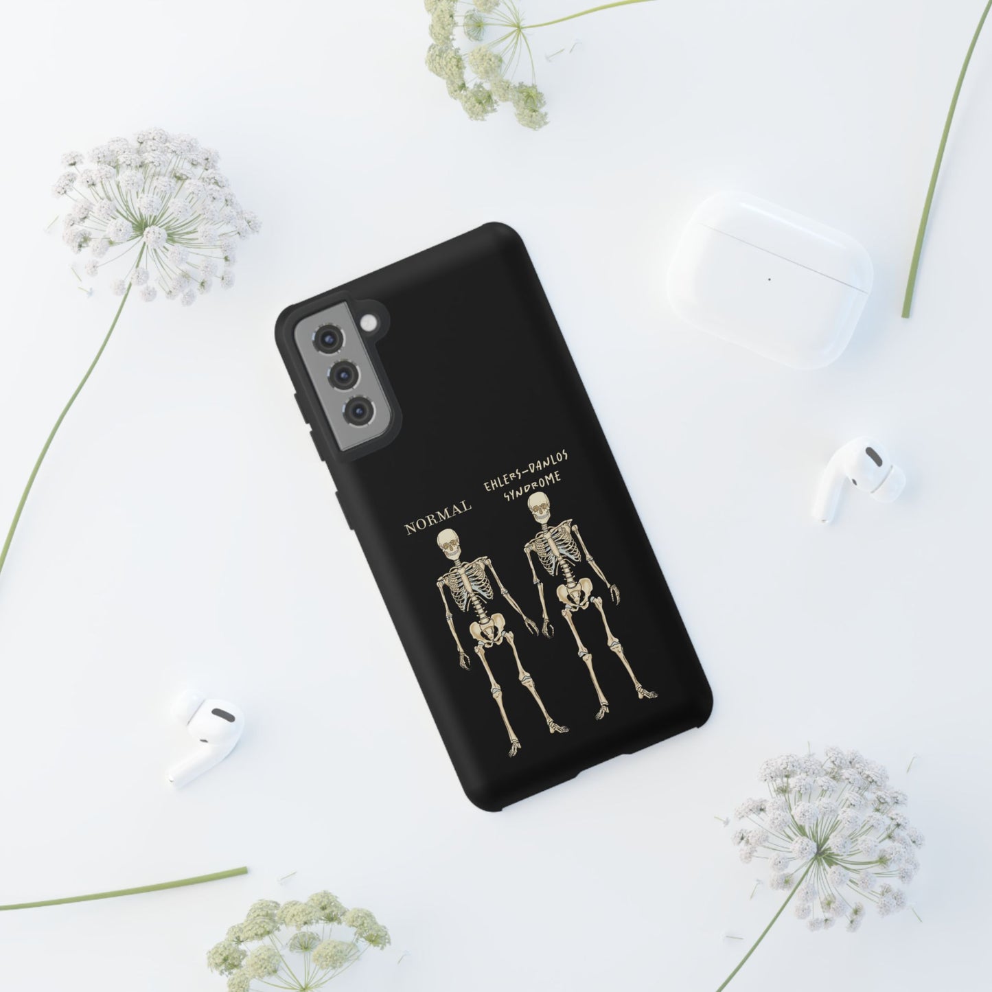 Black phone case with side-by-side skeletons—one labeled “normal,” the other “Ehlers-Danlos Syndrome”—to spread awareness about EDS and its effects. It is shown here resting on a table next to some headphones.