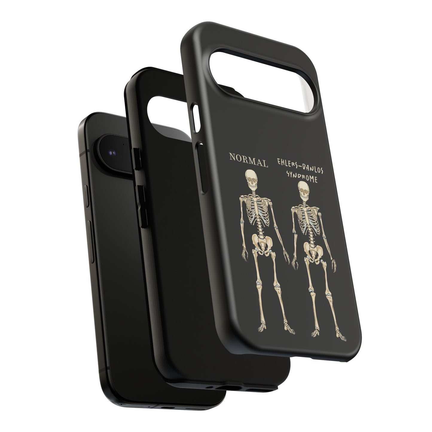 Black phone case with side-by-side skeletons—one labeled “normal,” the other “Ehlers-Danlos Syndrome”—to spread awareness about EDS and its effects. The case is displayed with it's separate layers here.