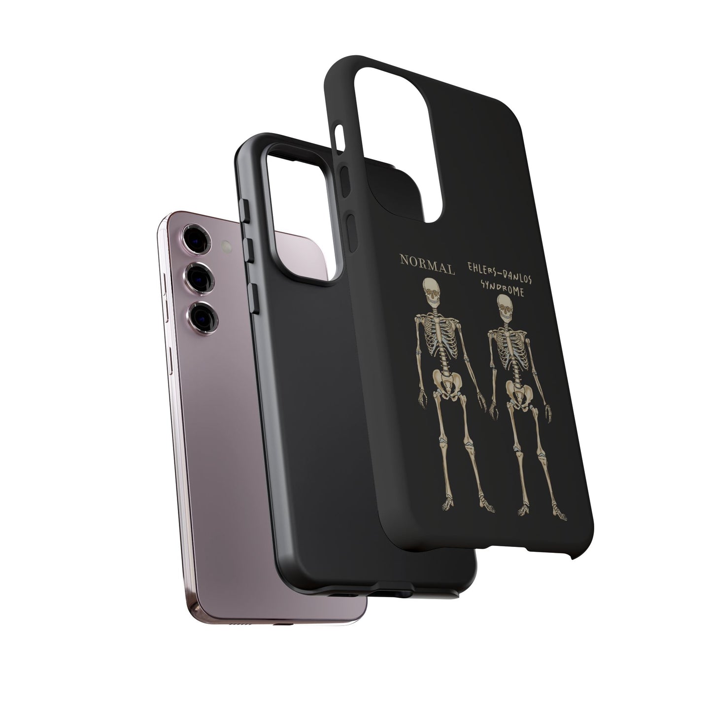 Black phone case with side-by-side skeletons—one labeled “normal,” the other “Ehlers-Danlos Syndrome”—to spread awareness about EDS and its effects. It is shown here with the layers apart to show what the case is made of.