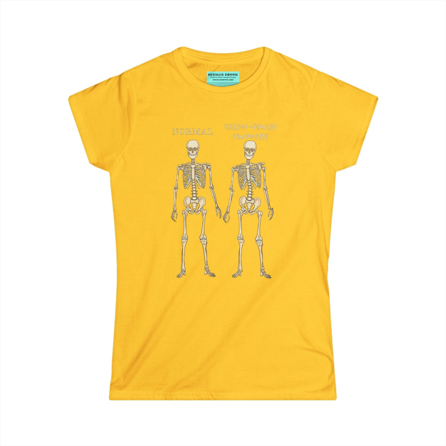 Women’s t-shirt in yellow with two skeletons side by side. The first is labeled 'Normal' and the second is labeled 'Ehlers-Danlos Syndrome,' visually illustrating the skeletal effects of EDS.