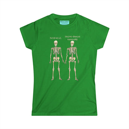 Women’s t-shirt in green with two skeletons side by side. The first is labeled 'Normal' and the second is labeled 'Ehlers-Danlos Syndrome,' visually illustrating the skeletal effects of EDS.