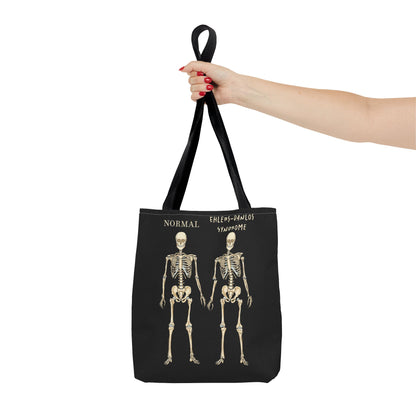 Black tote bag is held out to the side in a woman's hand. The tote displays two skeletons side by side. The first is labeled 'Normal' and the second is labeled 'Ehlers-Danlos Syndrome,' visually illustrating the skeletal effects of EDS.