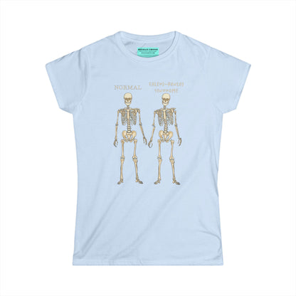 Women’s t-shirt in light blue with two skeletons side by side. The first is labeled 'Normal' and the second is labeled 'Ehlers-Danlos Syndrome,' visually illustrating the skeletal effects of EDS.