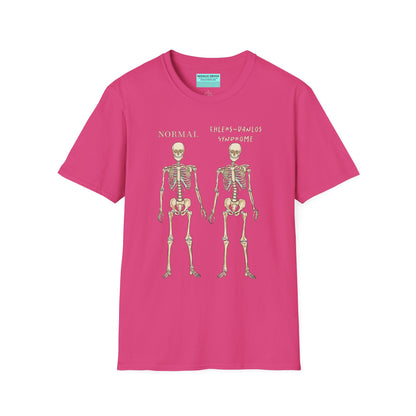 Pink unisex short sleeve t-shirt featuring two skeletons side by side—one labeled "normal," the other "Ehlers-Danlos Syndrome"—because connective tissue disorders deserve more visibility (and maybe a sense of humor, too).