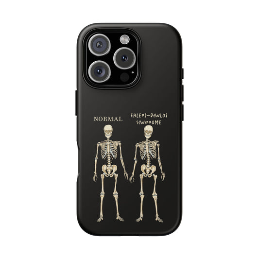 Black phone case with side-by-side skeletons—one labeled “normal,” the other “Ehlers-Danlos Syndrome”—to spread awareness about EDS and its effects.