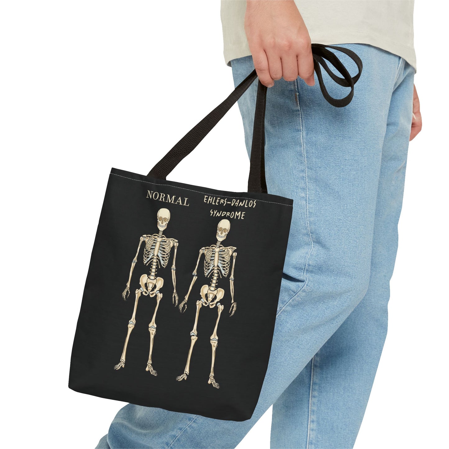 Black tote bag is is held in someone's hand. The tote displays two skeletons side by side. The first is labeled 'Normal' and the second is labeled 'Ehlers-Danlos Syndrome,' visually illustrating the skeletal effects of EDS.