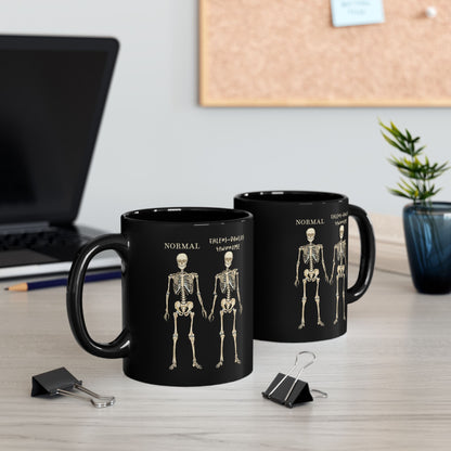 Ehlers Danlos Syndrome Mug, Black Ceramic Coffee Mug with EDS Design, EDS Awareness, Diagnosis Gift