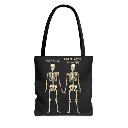 Black tote bag with two skeletons side by side. The first is labeled 'Normal' and the second is labeled 'Ehlers-Danlos Syndrome,' visually illustrating the skeletal effects of EDS.