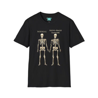 Ehlers-Danlos Syndrome Awareness T-Shirt, EDS Unisex Short Sleeve Graphic Tee, Zebra Gift