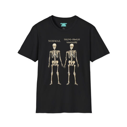Ehlers-Danlos Syndrome Awareness T-Shirt, EDS Unisex Short Sleeve Graphic Tee, Zebra Gift