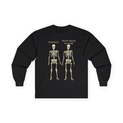 A black long sleeve shirt with two skeletons side by side—one labeled "normal," the other "Ehlers-Danlos Syndrome"—visually showcasing the effects of EDS with a clever, anatomy-inspired twist.