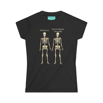 Women’s t-shirt in black with two skeletons side by side. The first is labeled 'Normal' and the second is labeled 'Ehlers-Danlos Syndrome,' visually illustrating the skeletal effects of EDS.