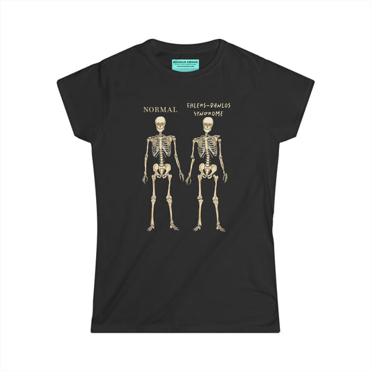 Women’s t-shirt in black with two skeletons side by side. The first is labeled 'Normal' and the second is labeled 'Ehlers-Danlos Syndrome,' visually illustrating the skeletal effects of EDS.