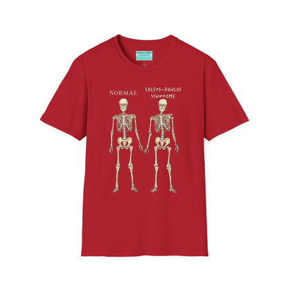 Red unisex short sleeve t-shirt featuring two skeletons side by side—one labeled "normal," the other "Ehlers-Danlos Syndrome"—because connective tissue disorders deserve more visibility (and maybe a sense of humor, too).