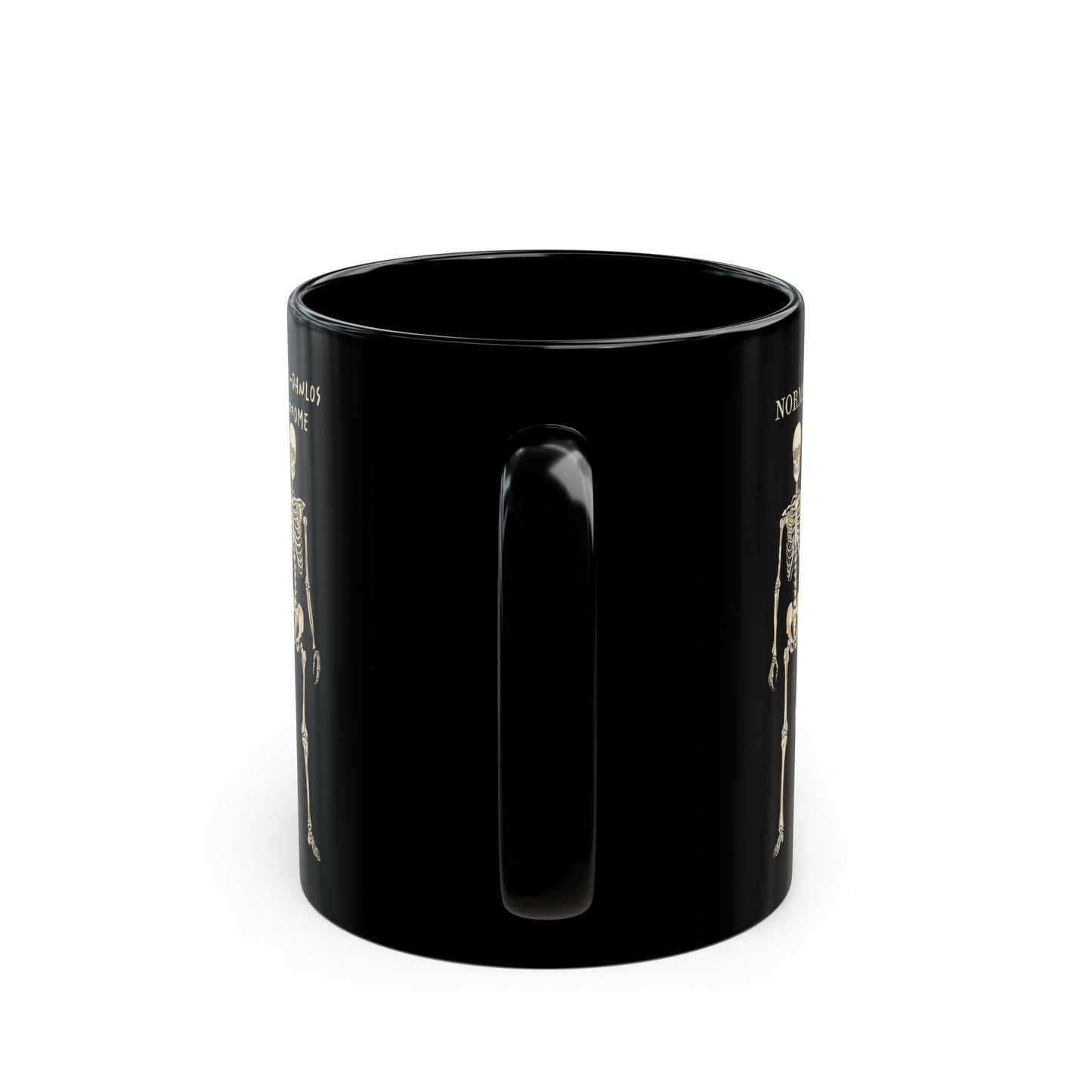 Ehlers Danlos Syndrome Mug, Black Ceramic Coffee Mug with EDS Design, EDS Awareness, Diagnosis Gift