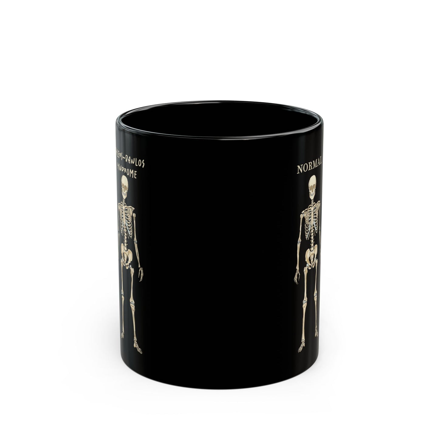 Ehlers Danlos Syndrome Mug, Black Ceramic Coffee Mug with EDS Design, EDS Awareness, Diagnosis Gift
