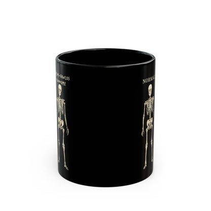 Ehlers Danlos Syndrome Mug, Black Ceramic Coffee Mug with EDS Design, EDS Awareness, Diagnosis Gift