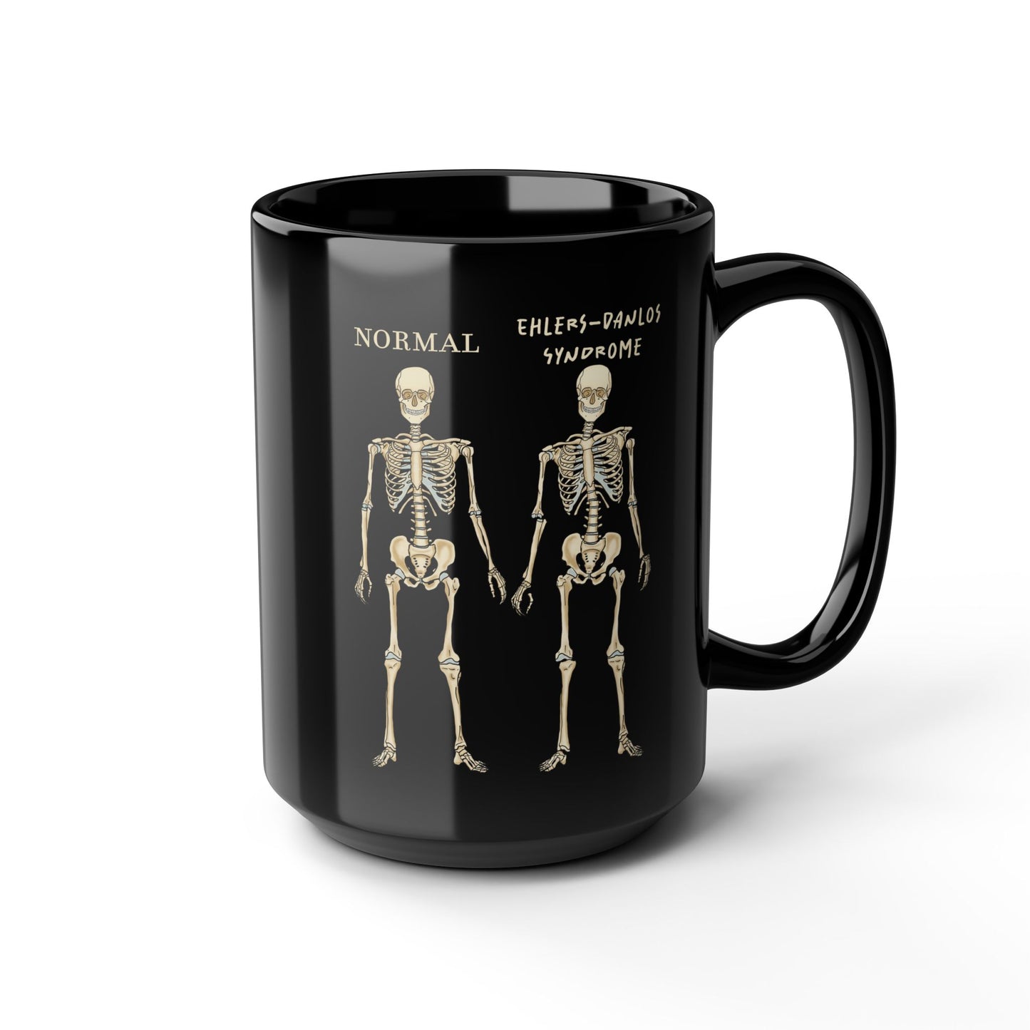 Ehlers Danlos Syndrome Mug, Black Ceramic Coffee Mug with EDS Design, EDS Awareness, Diagnosis Gift