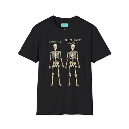 Black unisex short sleeve t-shirt featuring two skeletons side by side—one labeled "normal," the other "Ehlers-Danlos Syndrome"—because connective tissue disorders deserve more visibility (and maybe a sense of humor, too).
