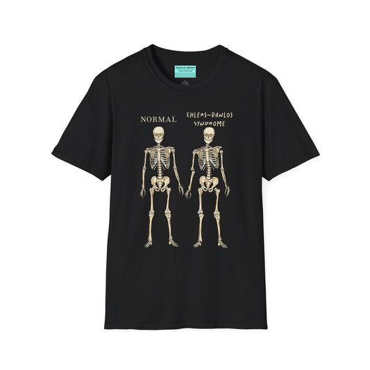 Black unisex short sleeve t-shirt featuring two skeletons side by side—one labeled "normal," the other "Ehlers-Danlos Syndrome"—because connective tissue disorders deserve more visibility (and maybe a sense of humor, too).