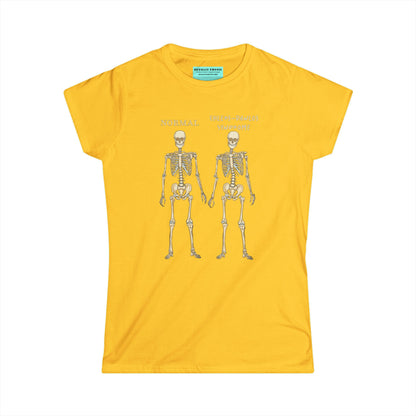 Women’s t-shirt in yellow with two skeletons side by side. The first is labeled 'Normal' and the second is labeled 'Ehlers-Danlos Syndrome,' visually illustrating the skeletal effects of EDS.
