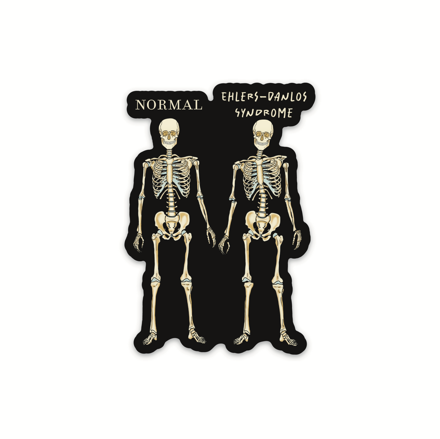 Ehlers-Danlos Syndrome Sticker, EDS Vinyl Sticker, Skeleton Comparison
