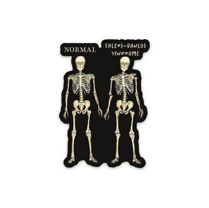 Ehlers-Danlos Syndrome Sticker, EDS Vinyl Sticker, Skeleton Comparison