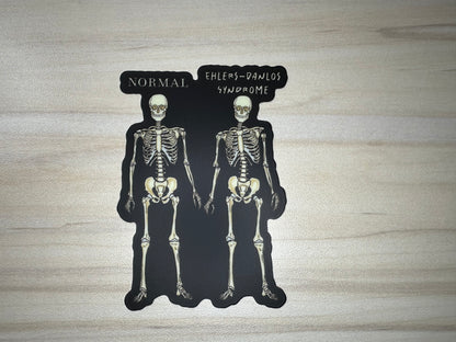 Ehlers-Danlos Syndrome Sticker, EDS Vinyl Sticker, Skeleton Comparison