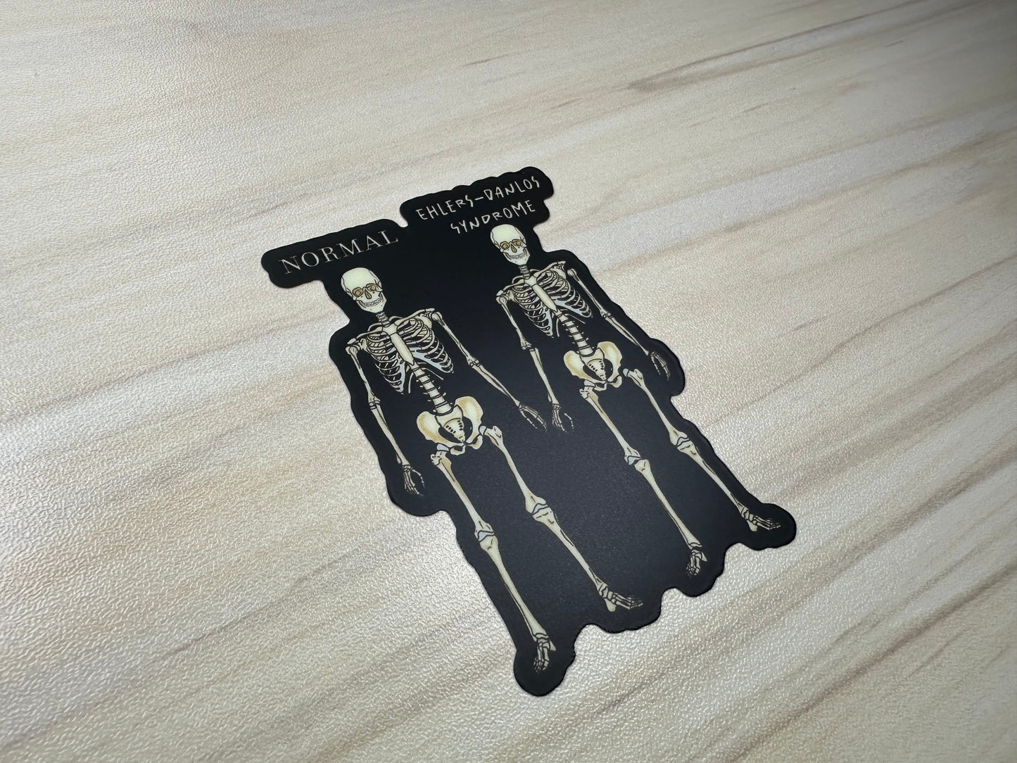 Ehlers-Danlos Syndrome Sticker, EDS Vinyl Sticker, Skeleton Comparison
