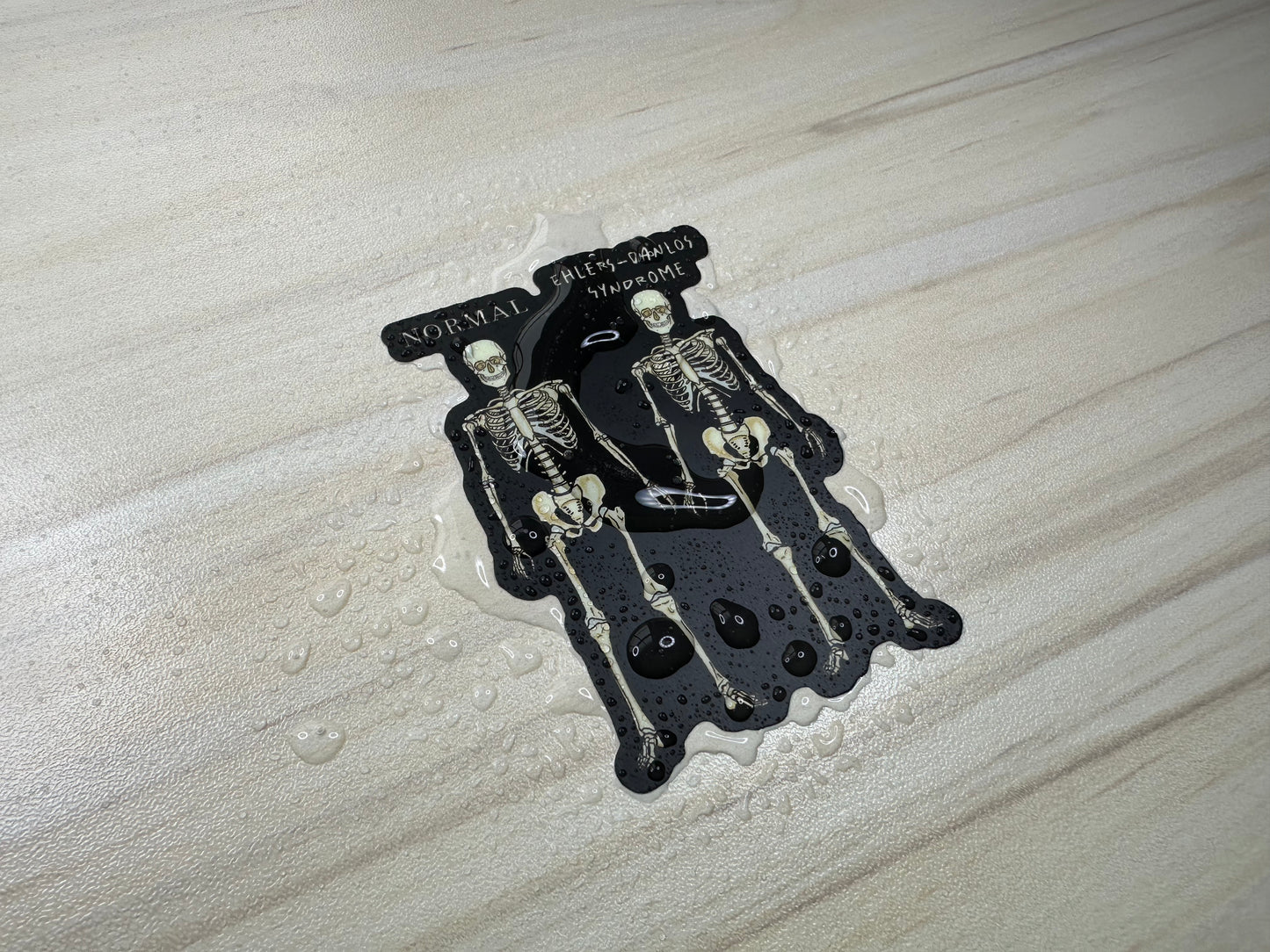 Ehlers-Danlos Syndrome Sticker, EDS Vinyl Sticker, Skeleton Comparison
