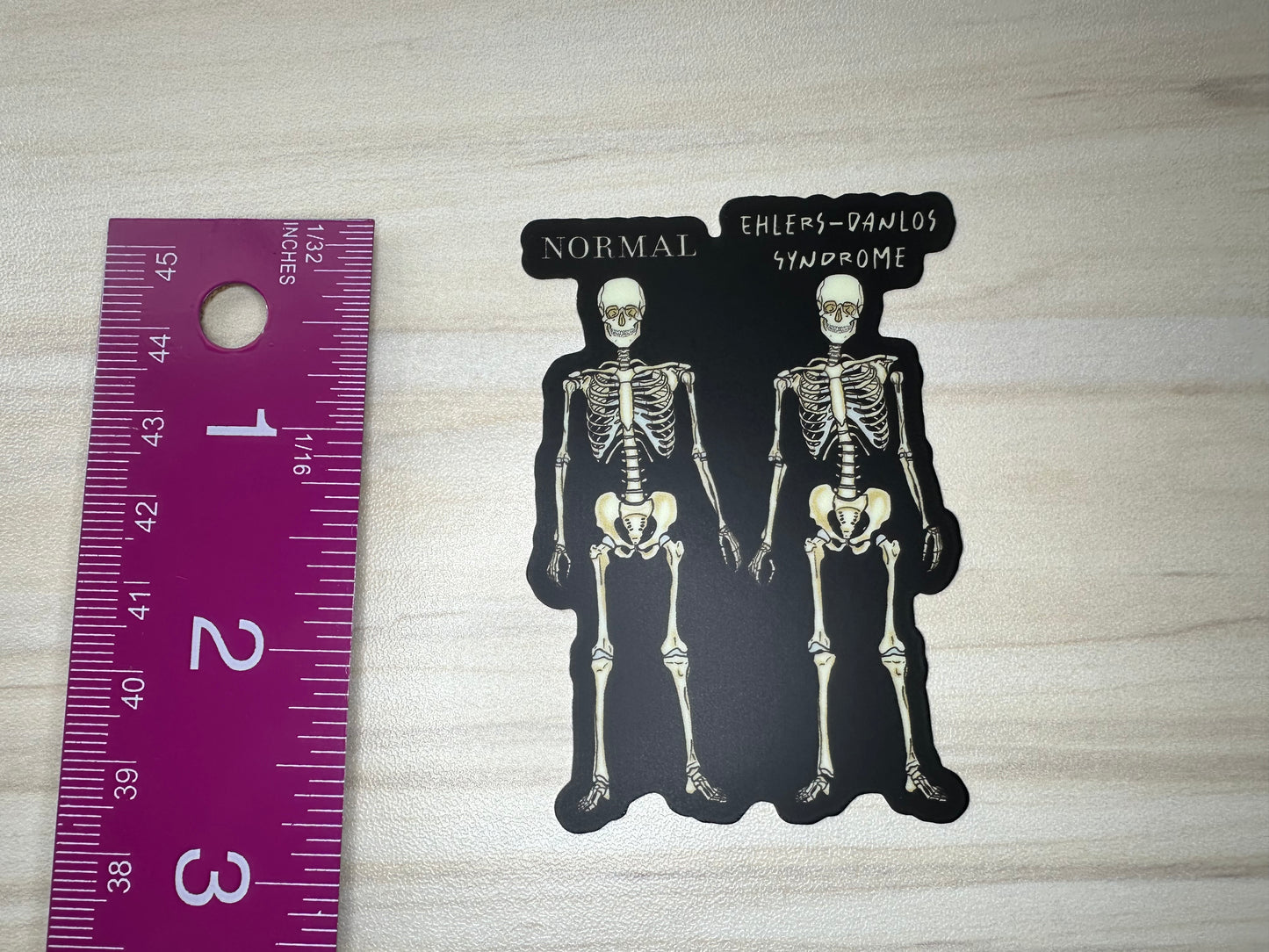 Ehlers-Danlos Syndrome Sticker, EDS Vinyl Sticker, Skeleton Comparison