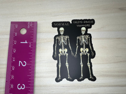 Ehlers-Danlos Syndrome Sticker, EDS Vinyl Sticker, Skeleton Comparison