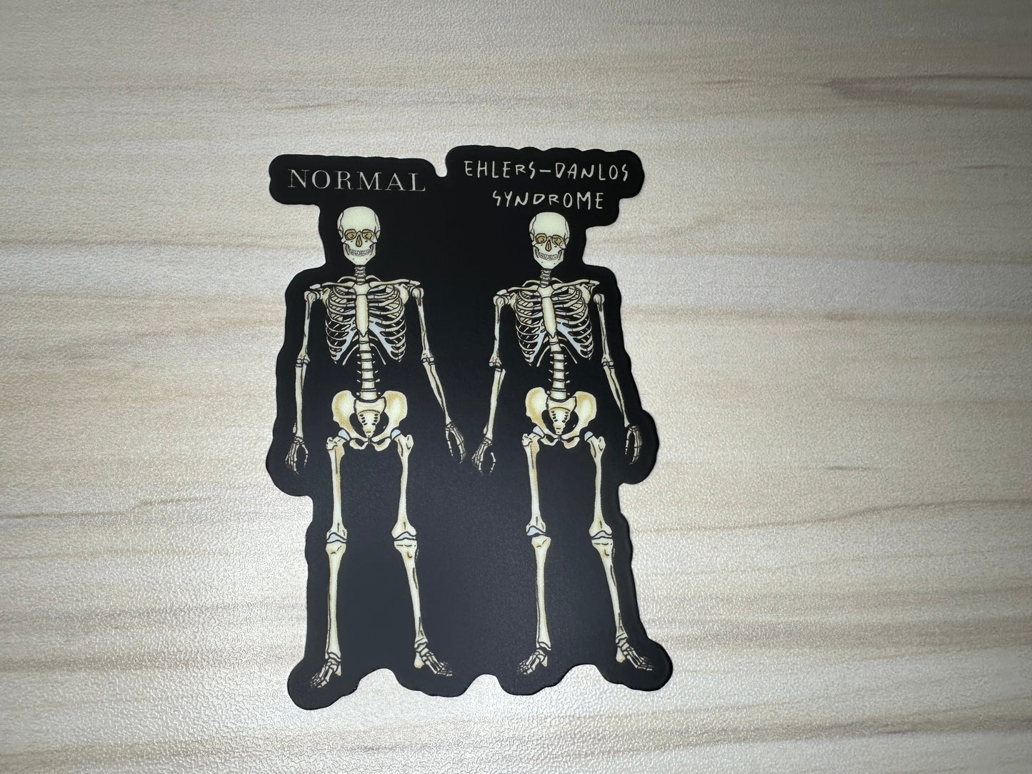 Ehlers-Danlos Syndrome Sticker, EDS Vinyl Sticker, Skeleton Comparison