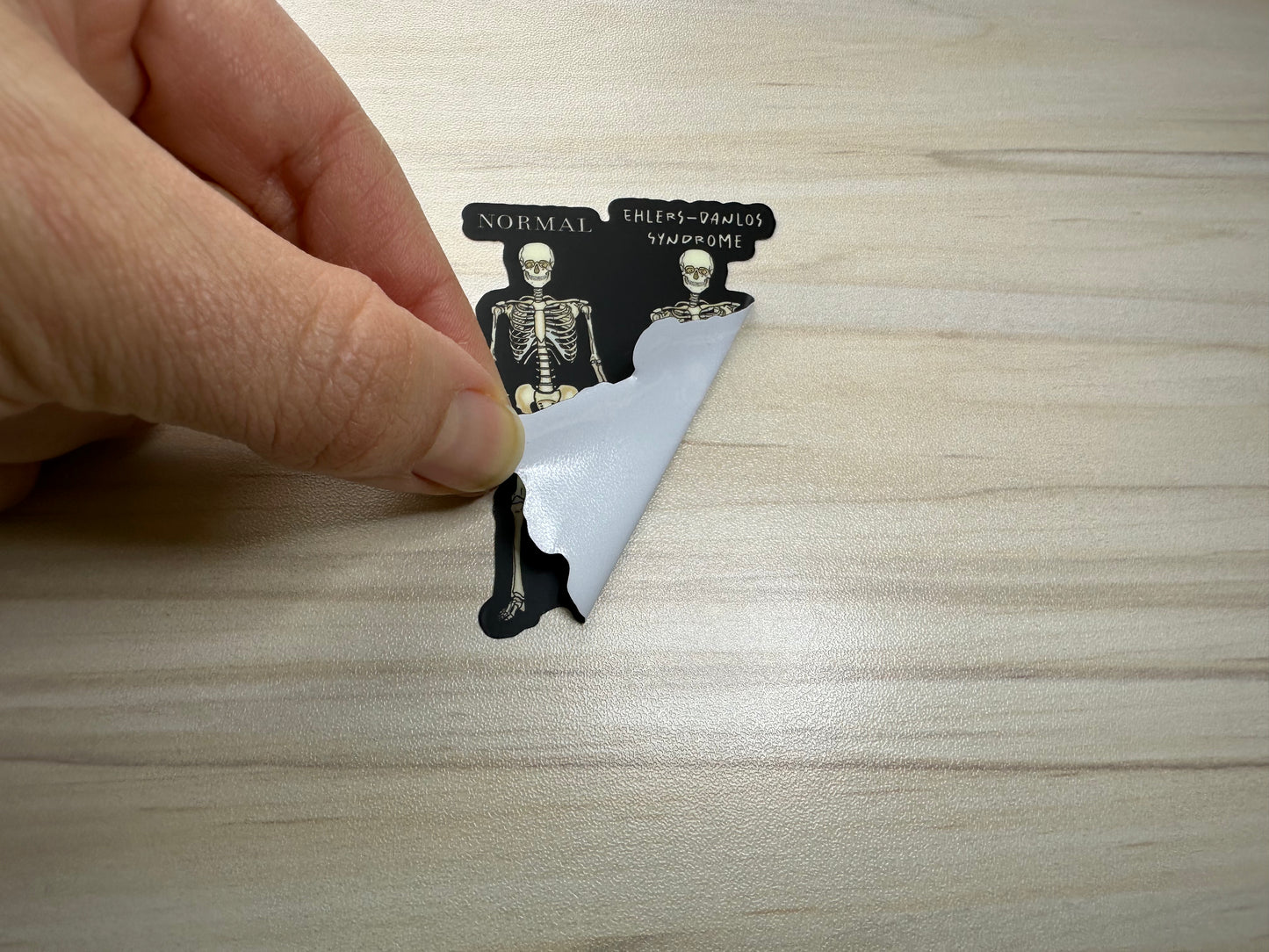 Ehlers-Danlos Syndrome Sticker, EDS Vinyl Sticker, Skeleton Comparison