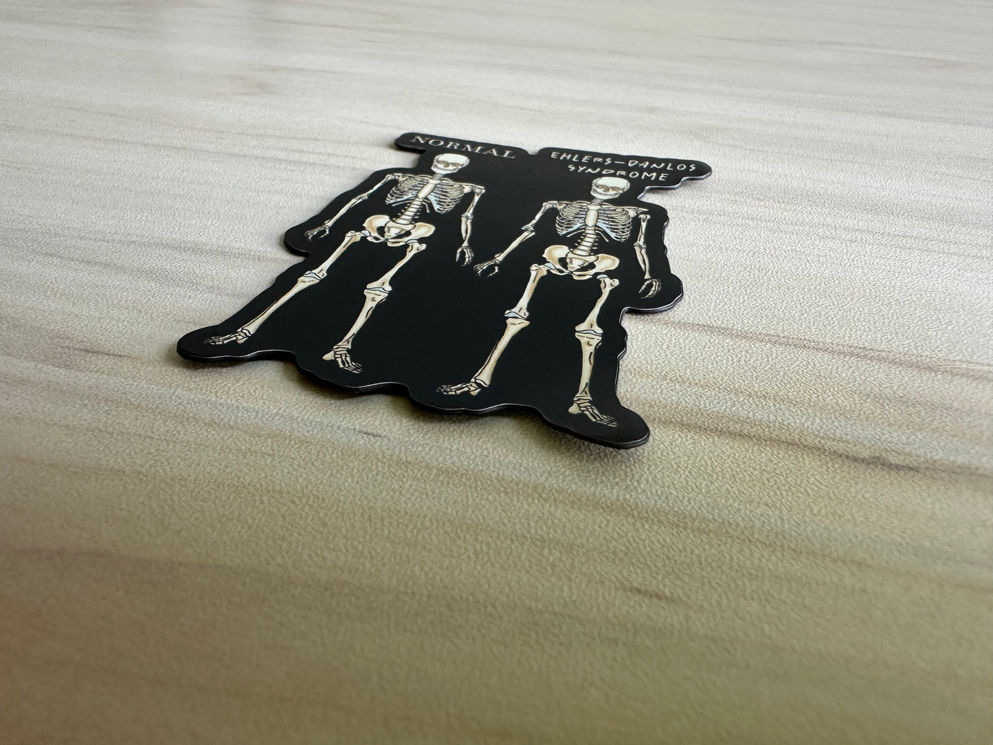 Ehlers-Danlos Syndrome Magnet, EDS Gift, Ehlers Danlos Fridge Magnet