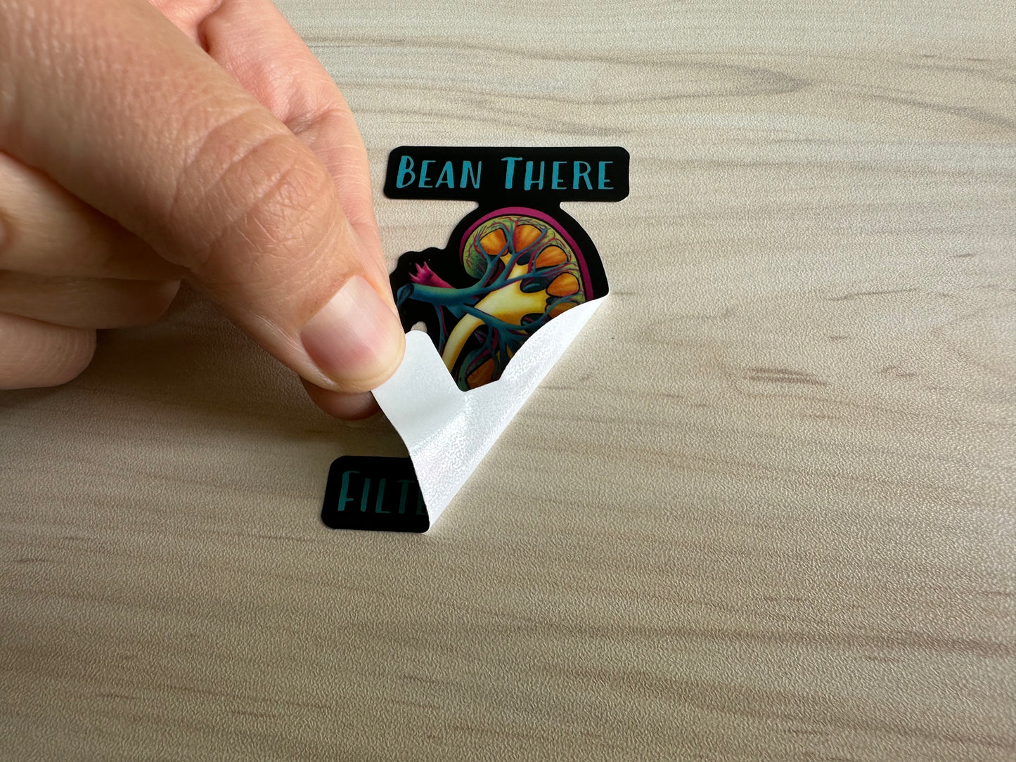 Funny Kidney Sticker, Nephrology Joke, Kidney Transplant Sticker, Vinyl Decal