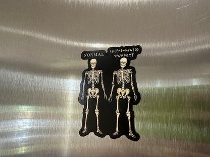 Ehlers-Danlos Syndrome Magnet, EDS Gift, Ehlers Danlos Fridge Magnet