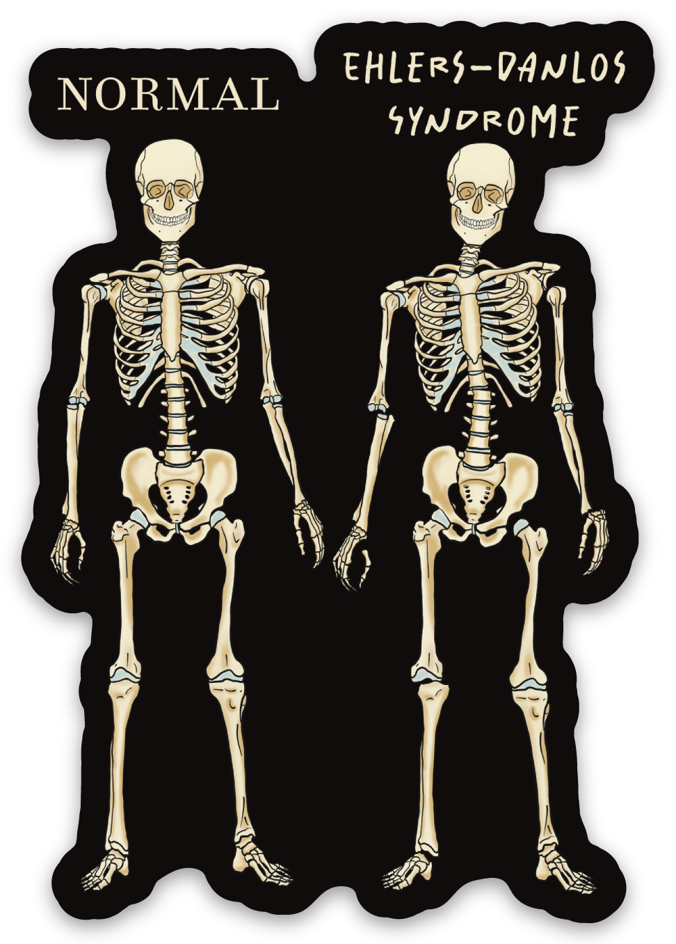 Ehlers-Danlos Syndrome Magnet, EDS Gift, Ehlers Danlos Fridge Magnet