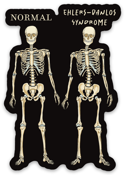 Ehlers-Danlos Syndrome Magnet, EDS Gift, Ehlers Danlos Fridge Magnet